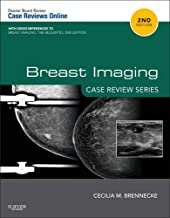 Breast Imaging Case review  series