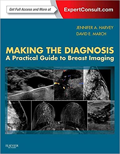 Making the Diagnosis : A Practical Guide for Breast Imaging