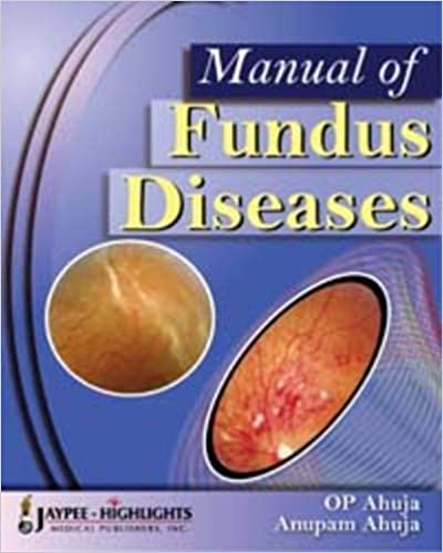 Manual of Fundus Diseasses